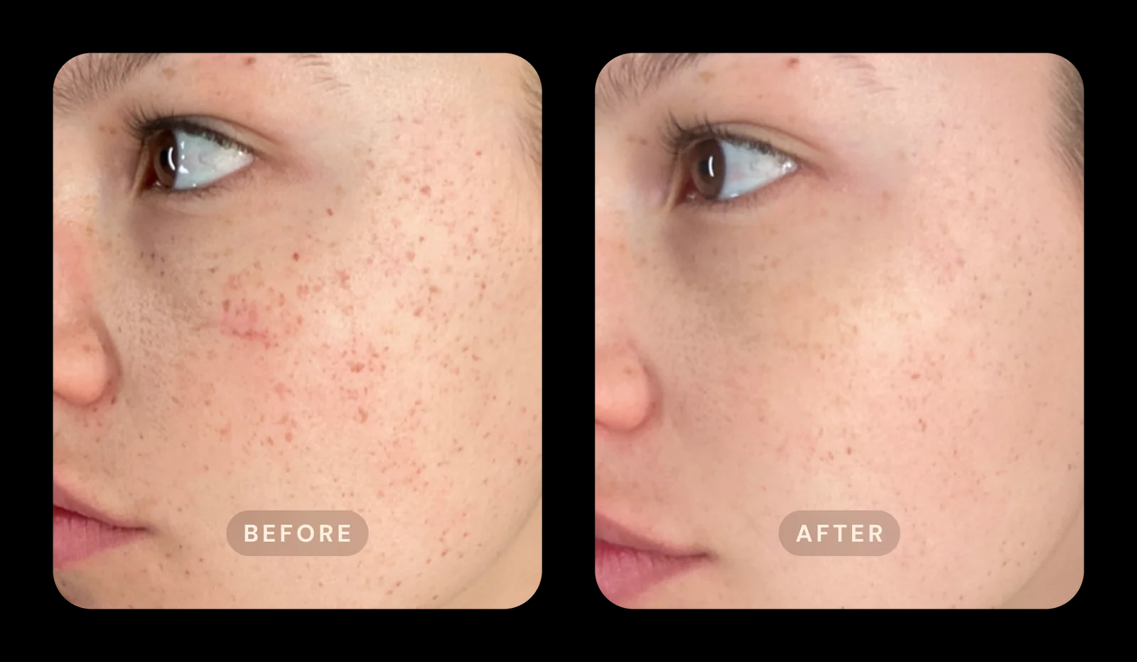 Comparación antes y después de tratamiento facial